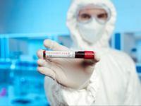 В Украине будет массовое тестирование на иммунитет к коронавирусу – Ляшко