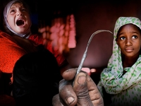 Женское обрезание: что это и зачем?