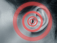 Почему звенит в ушах?