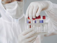 Медик назвал дату, когда коронавирус в Украине начнет сбавлять обороты