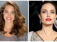 Делала ли пластику Анджелина Джоли: Комментарий эксперта