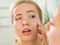 3 главные ошибки в уходе за сухой кожей