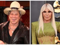 ТОП-7 мировых знаменитостей, которые изуродовали себя пластикой