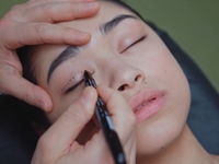 Блефаропластика: лише естетика та молодий погляд чи й покращення зору?