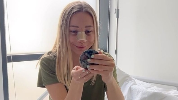 Жена Виктора Павлика показала, как изменилась ее внешность после пластики — фото до и после