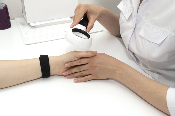 Основные причины появления папиллом