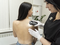 Основные причины появления папиллом, их виды и безопасные методы удаления