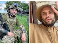 Звезде «Лиги смеха» Розовому вставили титановую пластину в череп: фото после операции