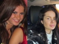 Блогерша Шаманская рассекретила, какие пластические операции делала